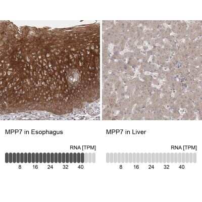 Immunohistochemistry-Paraffin MPP7 Antibody - BSA Free