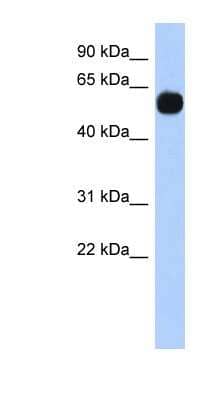 Western Blot: MPP7 Antibody [NBP1-53081] - HT1080 cell lysate, concentration 0.2-1 ug/ml.