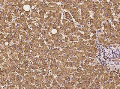 Immunohistochemistry-Paraffin: MPPE1 Antibody [NBP3-05976] - Staining of human MPPE1 in human liver with rabbit polyclonal antibody at 1:100 dilution.