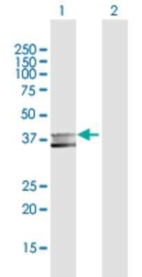 Western Blot: MPPE1 Antibody [H00065258-D01P] - Analysis of MPPE1 expression in transfected 293T cell line by MPPE1 polyclonal antibody.Lane 1: MPPE1 transfected lysate(39.10 KDa).Lane 2: Non-transfected lysate.