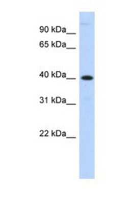 Western Blot: MPPE1 Antibody [NBP1-69305] - This Anti-MPPE1 antibody was used in Western Blot of Transfected 293T   tissue lysate at a concentration of 1ug/ml.