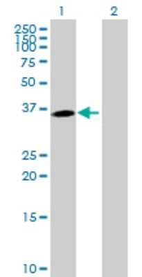 Western Blot: MPPED1 Antibody [H00000758-B01P] - Analysis of MPPED1 expression in transfected 293T cell line by MPPED1 polyclonal antibody.  Lane1:MPPED1 transfected lysate(35.97 KDa). Lane 2:Non-transfected lysate.