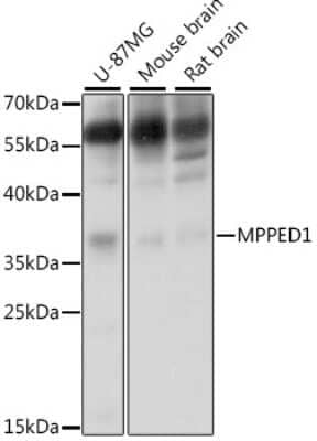 Western Blot: MPPED1 Antibody [NBP2-93345] - Analysis of extracts of various cell lines, using MPPED1 at 1:1000 dilution.Secondary antibody: HRP Goat Anti-Rabbit IgG (H+L) at 1:10000 dilution.Lysates/proteins: 25ug per lane.Blocking buffer: 3% nonfat dry milk in TBST.Detection: ECL Basic Kit .Exposure time: 3s.