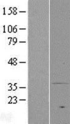 Western Blot: MPRA Overexpression Lysate (Adult Normal) [NBP2-04977] Left-Empty vector transfected control cell lysate (HEK293 cell lysate); Right -Over-expression Lysate for MPRA.