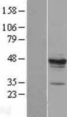 Western Blot: MPST Overexpression Lysate (Adult Normal) [NBP2-08720] Left-Empty vector transfected control cell lysate (HEK293 cell lysate); Right -Over-expression Lysate for MPST.