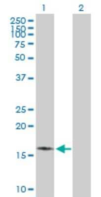 Western Blot: MPV17 Antibody [H00004358-B01P] - Analysis of MPV17 expression in transfected 293T cell line by MPV17 polyclonal antibody.  Lane 1: MPV17 transfected lysate(19.36 KDa). Lane 2: Non-transfected lysate.