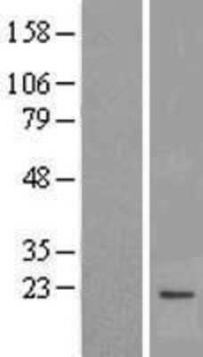 Western Blot: MPV17 Overexpression Lysate (Adult Normal) [NBL1-13211] Left-Empty vector transfected control cell lysate (HEK293 cell lysate); Right -Over-expression Lysate for MPV17.