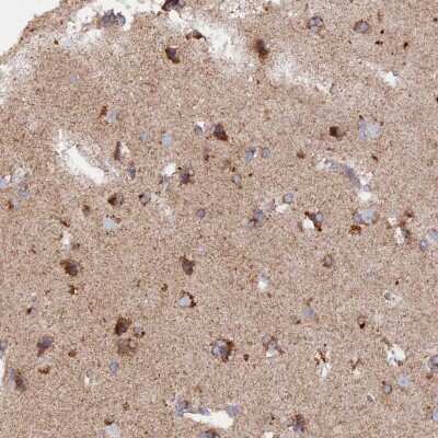 Immunohistochemistry-Paraffin: MPV17L Antibody [NBP1-83466] - Staining of human cerebral cortex shows cytoplasmic positivity in neurons.