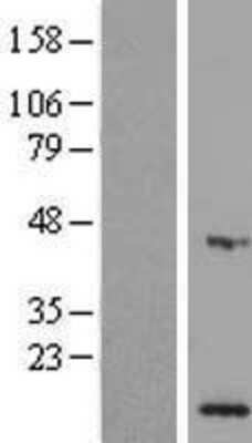 Western Blot MPV17L Overexpression Lysate