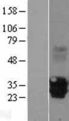 Western Blot: MPZL2 Overexpression Lysate (Adult Normal) [NBP2-07705] Left-Empty vector transfected control cell lysate (HEK293 cell lysate); Right -Over-expression Lysate for MPZL2.