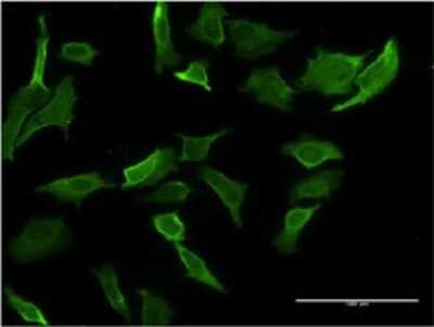 Immunocytochemistry/Immunofluorescence: MR1 Antibody (5B5) [H00003140-M04] - Analysis of monoclonal antibody to MR1 on HeLa cell. Antibody concentration 10 ug/ml