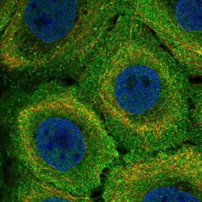Immunocytochemistry/Immunofluorescence: MR1 Antibody [NBP2-57625] - Staining of human cell line HaCaT shows localization to plasma membrane.