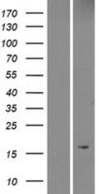 Western Blot: MRAP Overexpression Lysate (Adult Normal) [NBP2-04518] Left-Empty vector transfected control cell lysate (HEK293 cell lysate); Right -Over-expression Lysate for MRAP.