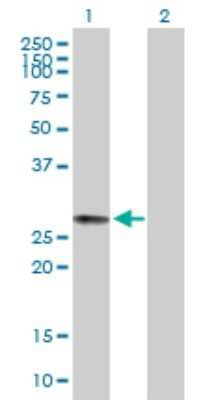 Western Blot: MRAP2 Antibody [H00112609-B01P] - Analysis of MRAP2 expression in transfected 293T cell line by MRAP2 polyclonal antibody.  Lane 1: C6orf117 transfected lysate(23.50 KDa). Lane 2: Non-transfected lysate.