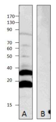 Western Blot: MRAP2 Antibody [NBP3-12226] - WB of NBP3-12226 with cDNA transfected MRAP (A) and control transfected MRAP (B). 1:500 antibody, dilution in DiluObuffer. Apparent MW is 19 and 39 kDa. 
