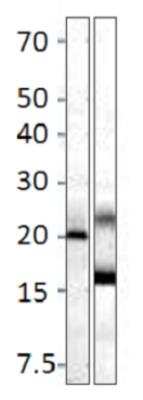 Western Blot: MRAP2 Antibody [NBP3-12227] - WB of NBP3-12227 tagged with recombinant MRAP (1) & PC_MRAP2 (2). 1:500 antibody dilution in DiluOBuffer. 