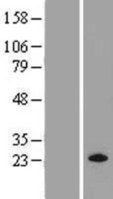 Western Blot: MRAS Overexpression Lysate (Adult Normal) [NBP2-08434] Left-Empty vector transfected control cell lysate (HEK293 cell lysate); Right -Over-expression Lysate for MRAS.
