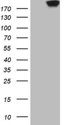 Western Blot: MRCK Antibody (12C12) [NBP2-46190] - Analysis of HEK293T cells were transfected with the pCMV6-ENTRY control (Left lane) or pCMV6-ENTRY MRCK.