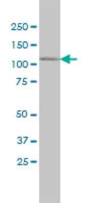 Western Blot: MRCK Antibody (1G7) [H00008476-M01] - Western Blot analysis of CDC42BPA expression in A-549 ( Cat # L025V1 ).