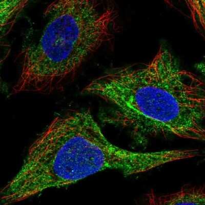 Immunocytochemistry/Immunofluorescence: MRCK Antibody [NBP2-55964] - Staining of human cell line SiHa shows localization to intermediate filaments. Antibody staining is shown in green.