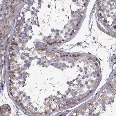 Immunohistochemistry-Paraffin: MRCK Antibody [NBP2-55964] - Staining of human testis shows moderate cytoplasmic positivity in cells in seminiferous ducts.