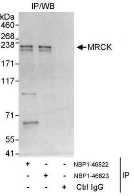 Immunoprecipitation: MRCK Antibody [NBP1-46822] - Samples:  Whole cell lysate (1 mg for IP, 20% of IP loaded) from HeLa cells.  Antibodies: Affinity purified rabbit anti-MRCK antibody NBP1-46822 used for IP at 3 ug/mg lysate.  MRCK was also immunoprecipitated by rabbit anti-MRCK antibody NBP1-46823, which recognizes a downstream epitope.  For blotting immunoprecipitated MRCK, NBP1-46822 was used at 1 ug/ml.  Detection: Chemiluminescence with an exposure time of 10 seconds.