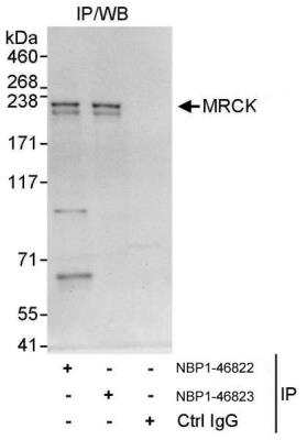 Immunoprecipitation: MRCK Antibody [NBP1-46823] - Samples: Whole cell lysate (1 mg for IP, 20% of IP loaded) from HeLa cells.  Antibodies: Affinity purified rabbit anti-MRCK antibody NBP1-46823 used for IP at 3 ug/mg lysate.  MRCK was also immunoprecipitated by rabbit anti-MRCK antibody NBP1-46822, which recognizes an upstream epitope.  For blotting immunoprecipitated MRC, NBP1-46822 was used at 1 ug/ml.  Detection: Chemiluminescence with an exposure time of 10 seconds.