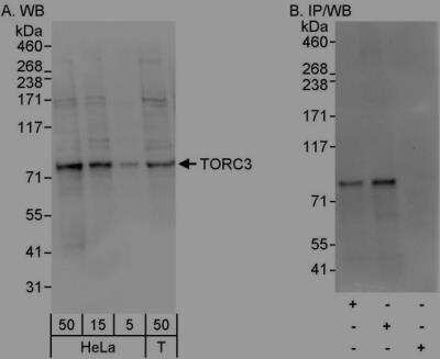 Immunoprecipitation: MRCK Antibody [NBP1-46823] - Samples: Whole cell lysate from HeLa (5, 15 and 50 ug for WB; 1 mg for IP, 20% of IP loaded) and 293T (T; 50 ug) cells. Antibodies: Affinity purified rabbit anti-TORC3 antibody used for WB at 0.04 ug/ml (A) and 0.4 ug/ml (B) and used for IP at 3 ug/mg lysate. TORC3 was also immunoprecipitated by rabbit anti-TORC3 antibody, which recognizes an upstream epitope. Detection: Chemiluminescence with exposure times of 10 seconds (A) and 3 seconds (B).