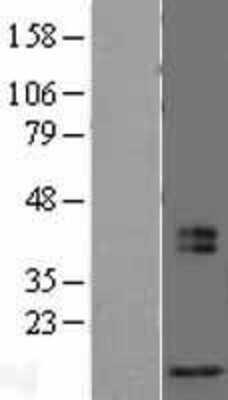 Western Blot: MRFAP1L1 Overexpression Lysate (Adult Normal) [NBL1-13222] Left-Empty vector transfected control cell lysate (HEK293 cell lysate); Right -Over-expression Lysate for MRFAP1L1.