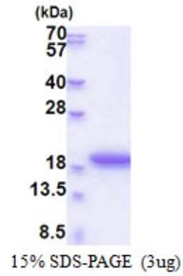 SDS-Page: MRFAP1L1 Recombinant Protein [NBP2-51583] - 15% SDS Page (3 ug)