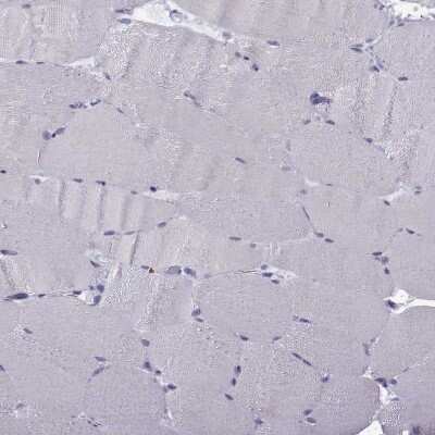 Immunohistochemistry-Paraffin: MRG-binding protein Antibody [NBP1-84936] - Staining of human Skeletal muscle shows very weak nuclear positivity in myocytes.