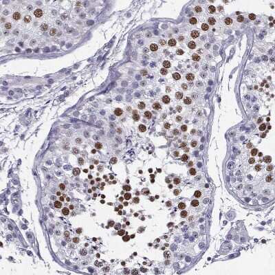 Immunohistochemistry-Paraffin: MRG-binding protein Antibody [NBP1-84936] - Staining of human Testis shows strong nuclear positivity in cells in seminiferous ducts.