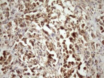 Immunohistochemistry: MRG15 Antibody (5D2) [NBP2-45908] - Analysis of Human bladder tissue. (Heat-induced epitope retrieval by Tris-EDTA, pH8.0)