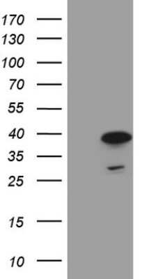 Western Blot: MRG15 Antibody (5D2) [NBP2-45908] - Analysis of HEK293T cells were transfected with the pCMV6-ENTRY control (Left lane) or pCMV6-ENTRY MRG15.