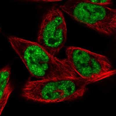 Immunocytochemistry/Immunofluorescence: MRG15 Antibody [NBP2-56097] - Staining of human cell line RH-30 shows localization to nuclear speckles.