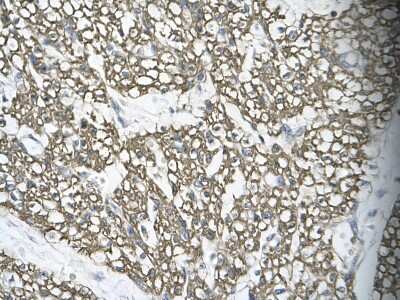 Immunohistochemistry: MRG15 Antibody [NBP1-57832] - Human cardiac cell Cellular data: Epithelial cells of renal tubule Antibody Concentration: 4.0-8.0 ug/ml Magnification: 400X.