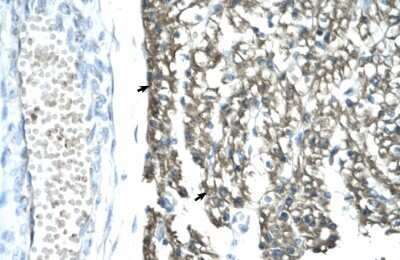 Immunohistochemistry-Paraffin: MRG15 Antibody [NBP1-57832] - Human Heart Tissue, antibody concentration 4-8ug/ml. Cells with positive label: Myocardial cells (indicated with arrows) 400X magnification.