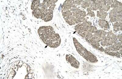 Immunohistochemistry-Paraffin: MRG15 Antibody [NBP1-57832] - Human urinary bladder tissue, Ganglionic cells (Indicated with Arrows) 4-8ug/ml.