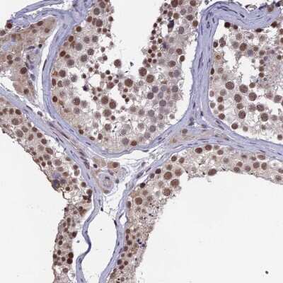 Immunohistochemistry-Paraffin: MRG15 Antibody [NBP1-84937] - Staining of human testis shows nuclear positivity in seminiferous ducts.