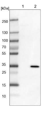 Western Blot: MRG15 Antibody [NBP1-84937] - Lane 1: Mouse liver tissue lysate Lane 2: Rat liver tissue lysate