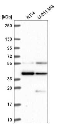 Western Blot: MRG15 Antibody [NBP2-56097] - Western blot analysis in human cell line RT-4 and human cell line U-251 MG.