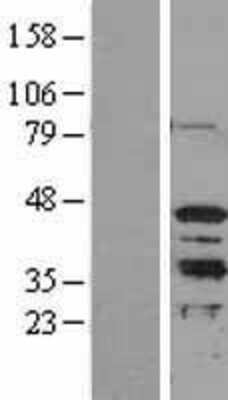 Western Blot: MRG15 Overexpression Lysate (Adult Normal) [NBL1-13183] Left-Empty vector transfected control cell lysate (HEK293 cell lysate); Right -Over-expression Lysate for MRG15.