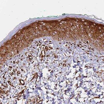 Immunohistochemistry-Paraffin: MRGPRE Antibody [NBP1-91962] -  Staining of human skin shows strong cytoplasmic positivity in keratinocytes, melanocytes and fibroblasts.