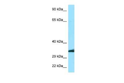 Western Blot: MRGPRE Antibody [NBP2-85312] - WB Suggested Anti-MRGPRE Antibody. Titration: 1.0 ug/ml. Positive Control: A549 Whole Cell
