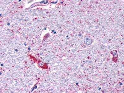 Immunohistochemistry-Paraffin: MRGPRF Antibody [NLS1983] - Analysis of anti-MRGPRF antibody with brain, neurons and glia at 11 ug/ ml.