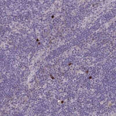 Immunohistochemistry-Paraffin: MRGX2 Antibody [NBP2-33744] - Staining of human lymph node shows strong cytoplasmic/membranous positivity in a small subset of non-germinal center cells, possibly mast cells.