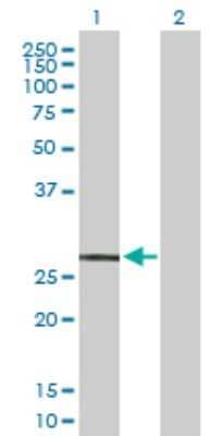 Western Blot: MRGX2 Antibody [H00117194-B02P] - Analysis of MRGPRX2 expression in transfected 293T cell line by MRGPRX2 polyclonal antibody.  Lane 1: MRGPRX2 transfected lysate(36.3 KDa). Lane 2: Non-transfected lysate.