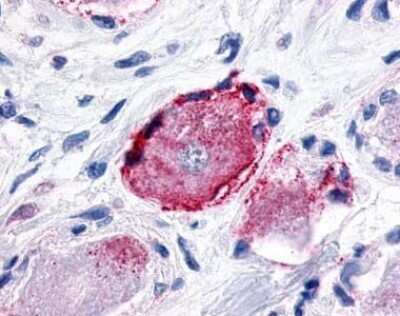 Immunohistochemistry-Paraffin: MRGX3 Antibody [NLS5122] - Analysis of anti-MRGPRX3 / MRGX3 antibody with dorsal root ganglion.