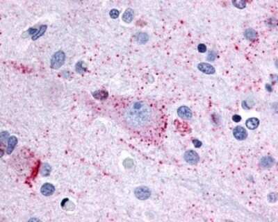 Immunohistochemistry-Paraffin: MRGX3 Antibody [NLS5122] - Analysis of anti-MRGPRX3 / MRGX3 antibody with human brain, cortex.