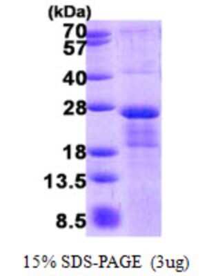 SDS-Page: MRI/modulator of retrovirus infection homolog Protein [NBP2-22782]